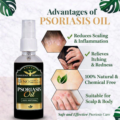 Garuda Herbal Psoriasis Oil-Advanced Psoriasis Clearing Oil